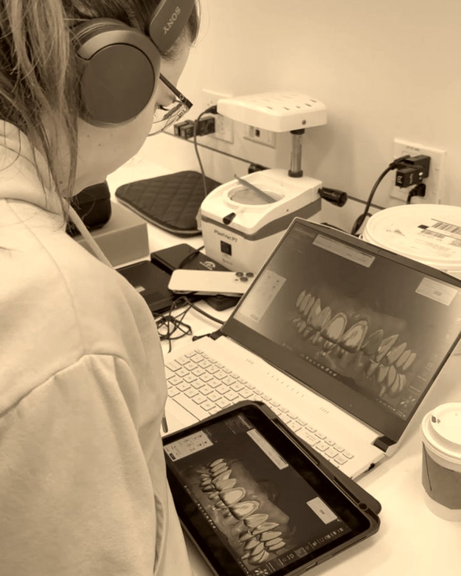 Digital design of restorations