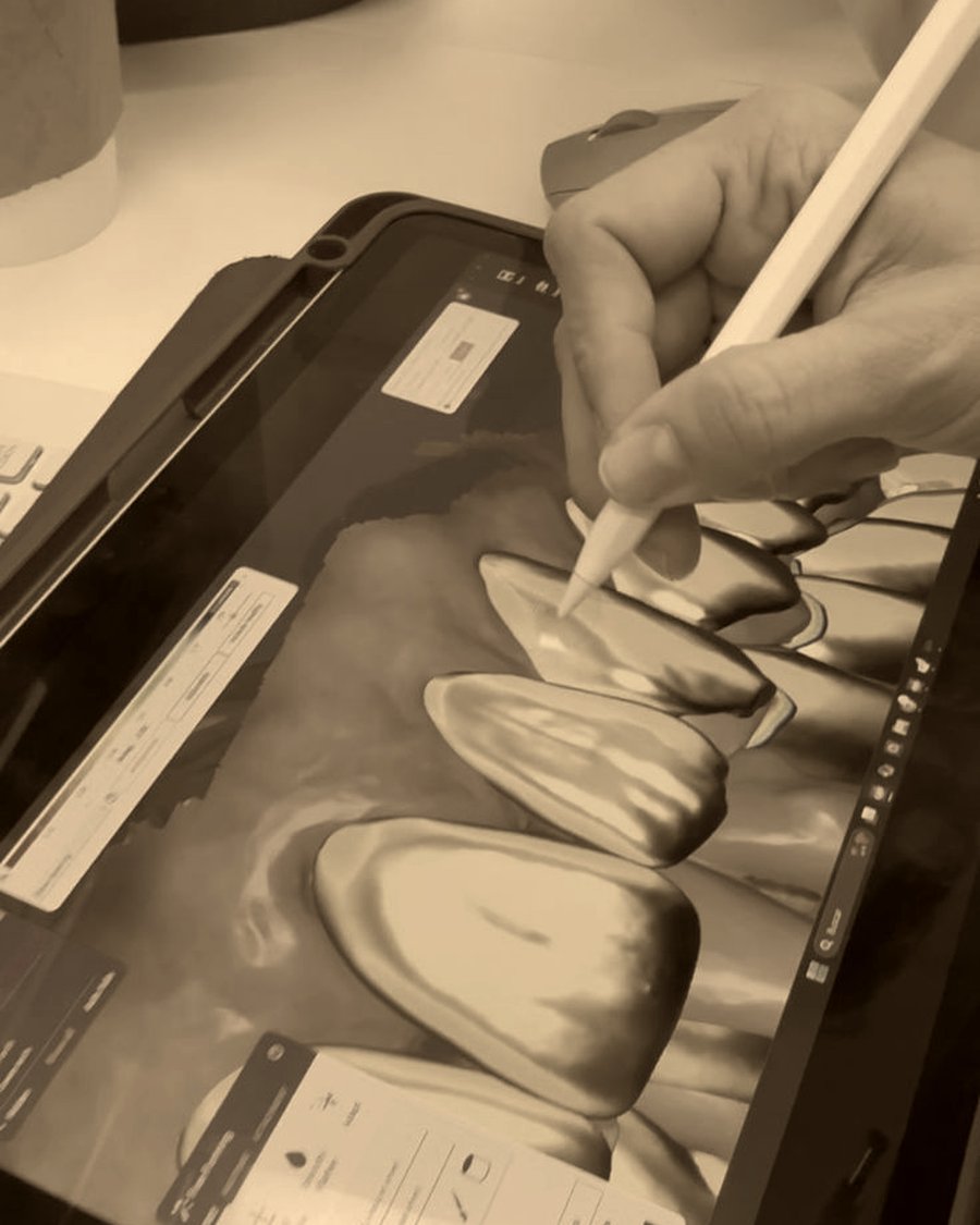 Refining the digital design