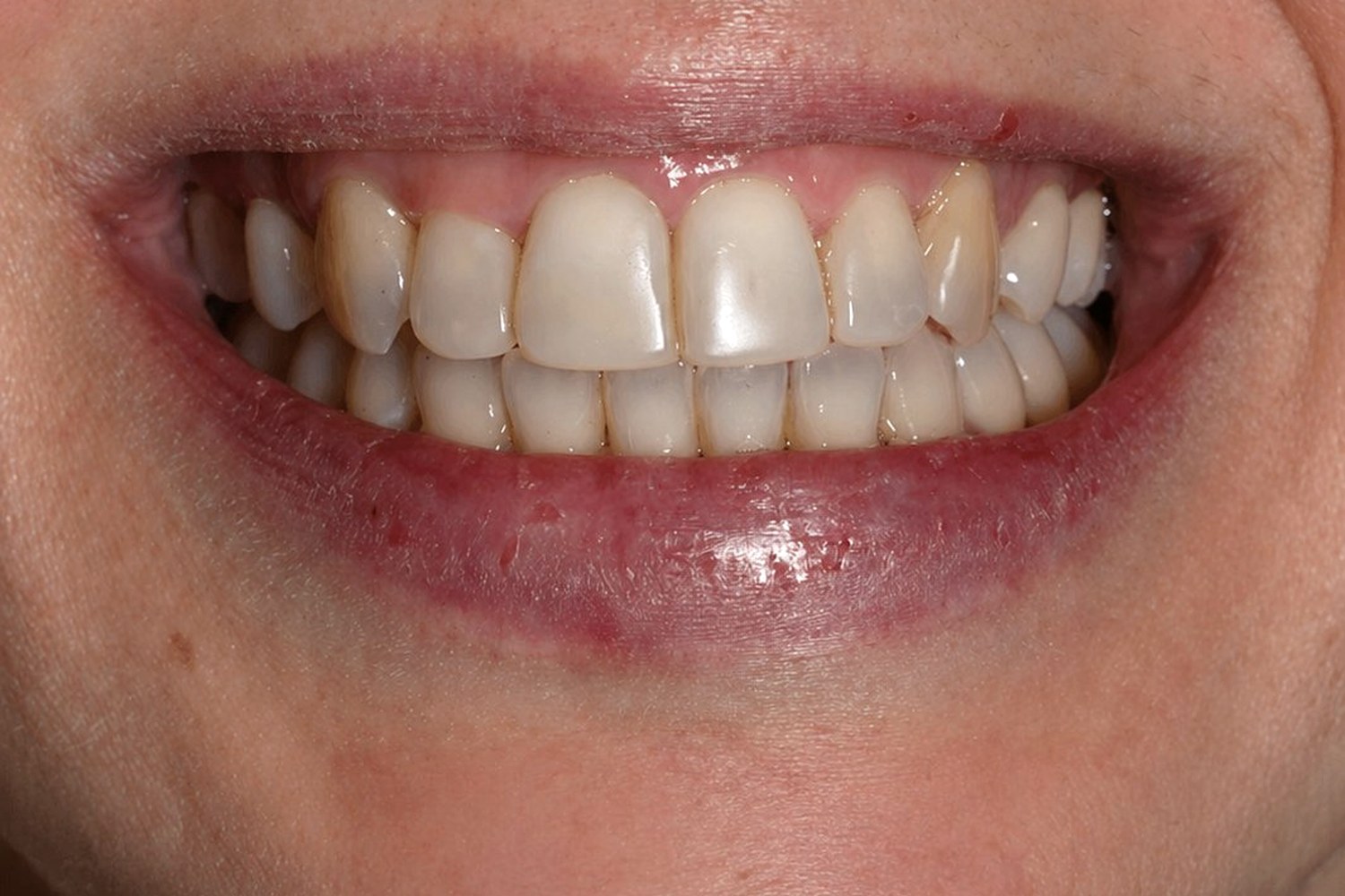 Featured case — before treatment