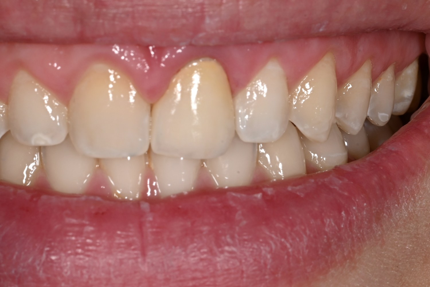 Featured case 03 — after (mirrored anatomy restoration)